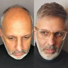 Diva Maker Michael hårprotese med naturlig fall