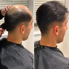 Diva Maker Hair Prosthetics Johan parykk med sikker feste