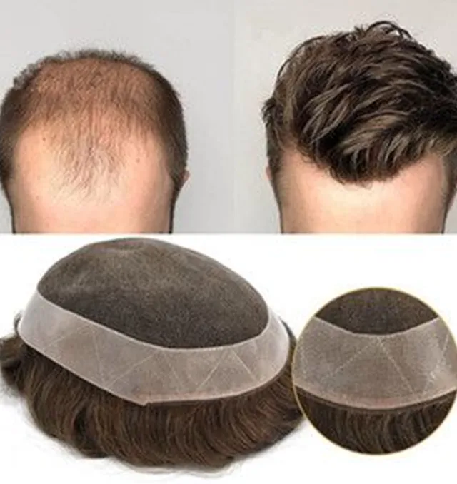 Diva Maker Hair Prosthetics Garth parykk med myk bunn