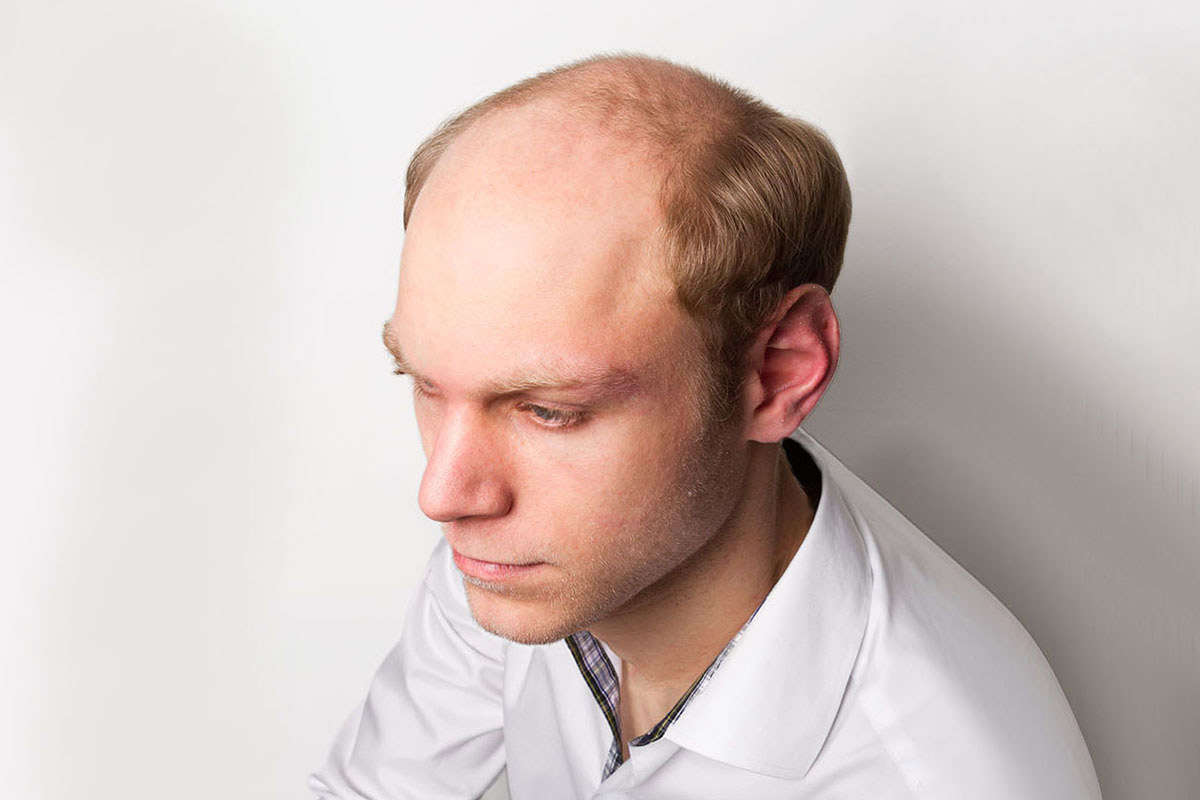 Perma-Rite Active-Skin hårstykke transparent